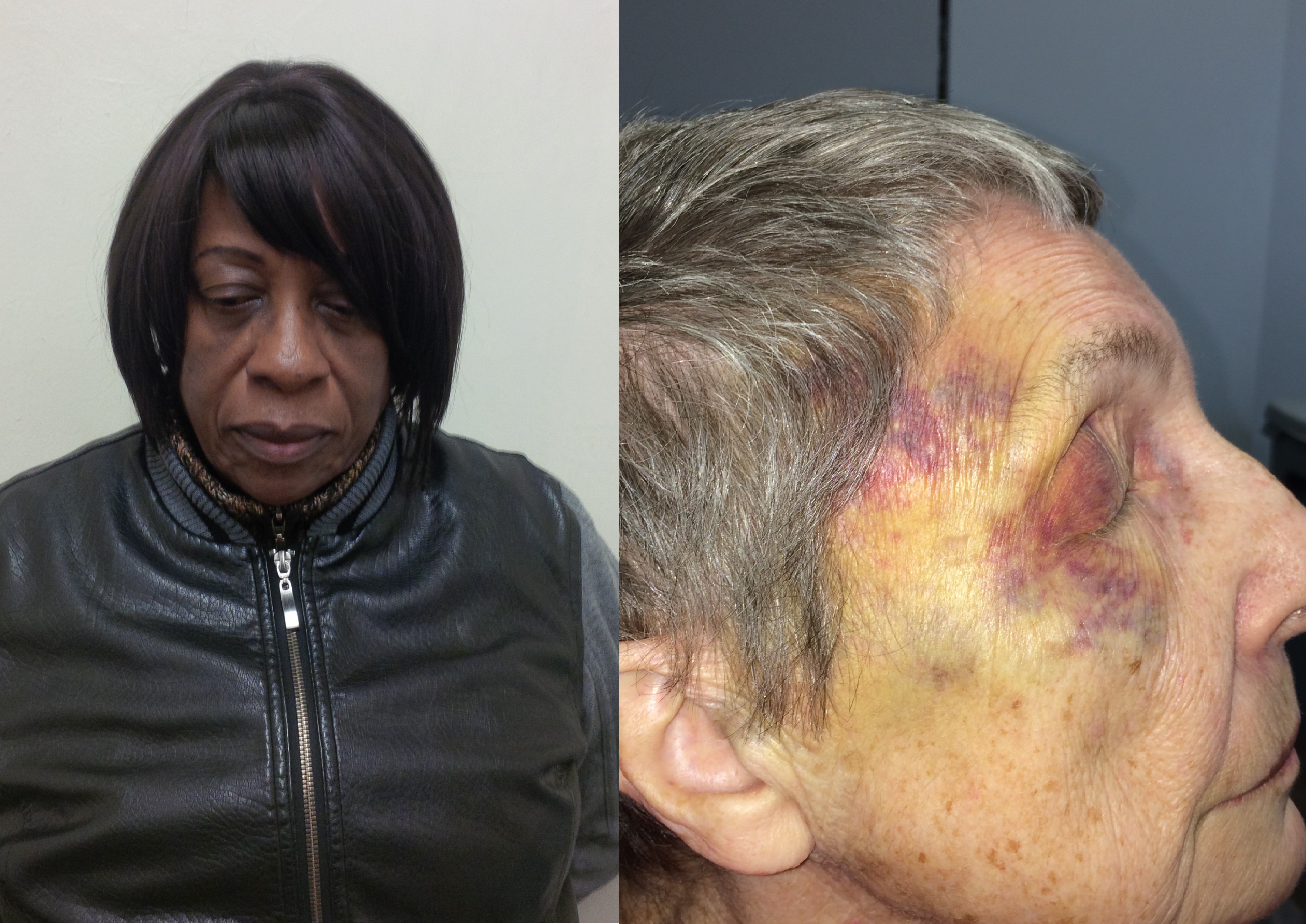 Marie Jeanty (left), a certified nurse aide, is being charged for repeatedly striking an 80-year-old nursing home resident.