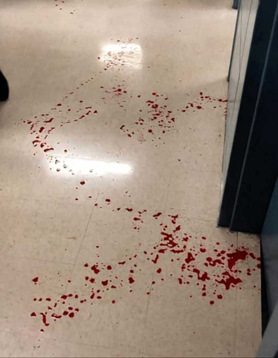 Teenager turns himself in after slashing student at Benjamin Cardozo High School in Bayside: NYPD