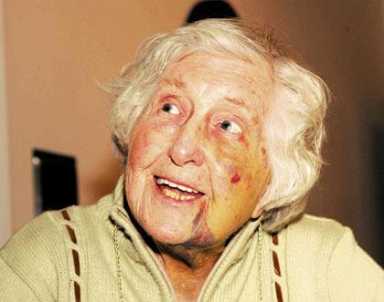 Granny beating retrial begins