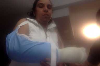 Clelias-Broken-Arm-Pinho