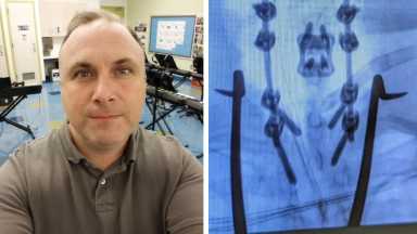 Gerasimos-Gianutsos-L-and-X-ray-image-of-his-nec-R